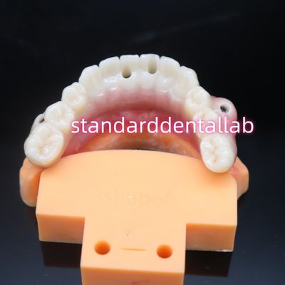 Cây ghép răng màu Zirconia phù hợp với sinh học