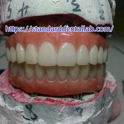 Cấy ghép răng Vương miện tạm thời PMMA cầu với sứ màu hồng