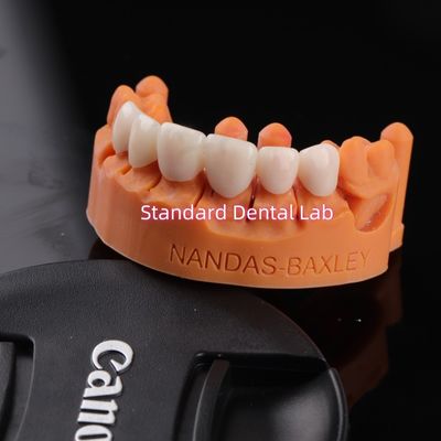 Sự thoải mái và chức năng với Digital CAD CAM Dental Lab Translucent Layered Zirconia Bridge