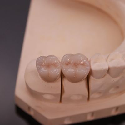 Vương miện Zirconia thoải mái với kết thúc thẩm mỹ chính xác Express 3-4 ngày Thời gian hoàn thành