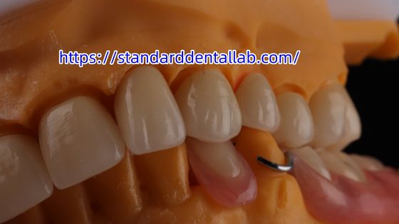 Lớp nha khoa Zirconia vương miện và cầu xuyên suốt 3D PRO Zirconia sứ vương miện phòng thí nghiệm nha khoa tiêu chuẩn