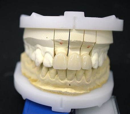 Đường cầu vương miện Zirconia chính xác Thích hợp / thẩm mỹ thoải mái 3-4 ngày Thời gian quay nhanh