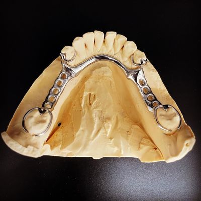 Fast và Cast Frame Co-Cr Metal phần răng giả khung cho các chuyên gia nha khoa
