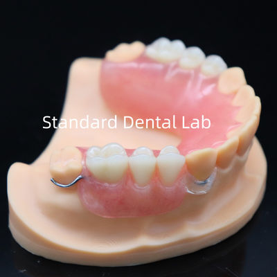 High Esthetics acrylic răng giả một phần với khóa rõ ràng và răng acrylic Trung Quốc Phòng thí nghiệm nha khoa