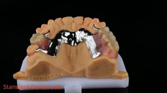 CorCr kim loại răng giả một phần cao ánh sáng Beryllium miễn phí Ivoclar Scheftner thoải mái khung kim loại