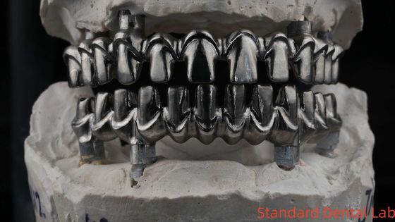 Dental Hybrid Malo Implant Bridge chuyên nghiệp hoàn hảo phù hợp FDA chứng nhận