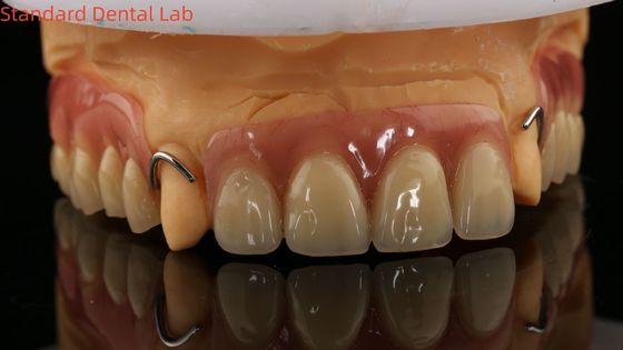 Nhiệt chữa Ivoclar phần Acrylic răng giả Phòng thí nghiệm nha khoa Độ chính xác cao với mô hình in 3D