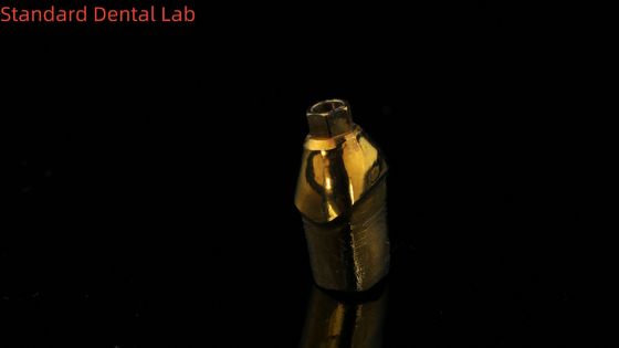 Đồ đeo răng tinh khiết bằng Titanium là giải pháp hoàn hảo cho việc phục hồi răng