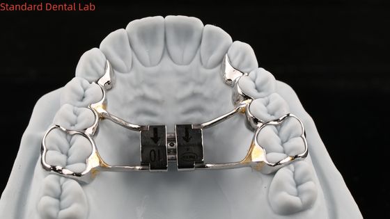 Arch Teeth Palate Expander ổn định Hyrax Palatal Expander hoàn hảo phù hợp SDL thiết bị chỉnh nha phòng thí nghiệm nha khoa