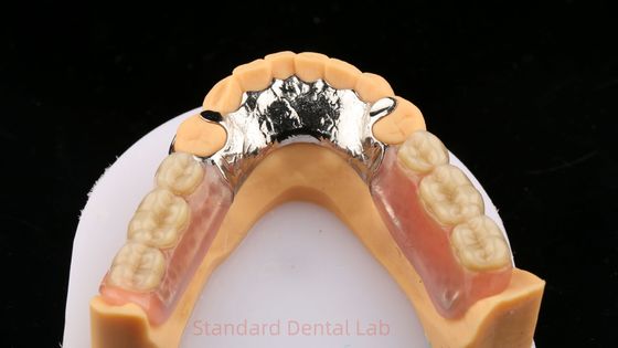 Kim loại hợp kim Cobalt Chromium phần răng giả Ivoclar Scheftner thoải mái Cast Metal Framewrok