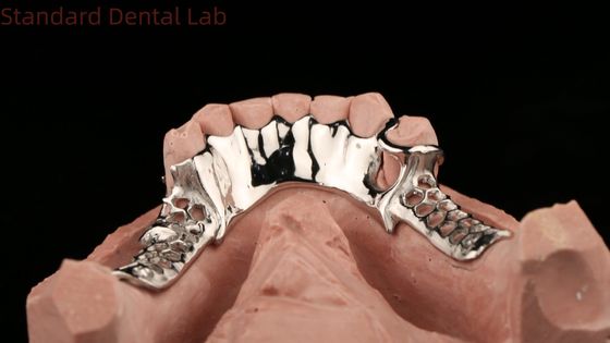 Cobalt Chrome Cast Metal Frame Phần răng giả với mặt nạ dưới Thiết kế SDL Dental Lab