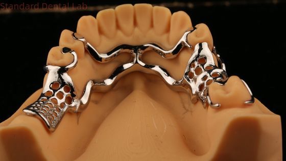 Hình khung kim loại đúc phía trên răng giả một phần mạnh mẽ nhẹ và bền