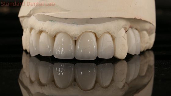 Trung Quốc Phòng thí nghiệm nha khoa Zirconia Full Contour Crown High Aesthetic Natural Dental Bridge 5 năm bảo hành
