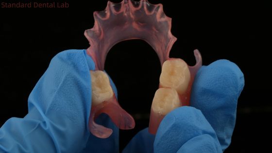 Răng TCS Valplast Dental Valplast linh hoạt phần răng giả Nesbit Valplast Finish Trung Quốc Phòng thí nghiệm nha khoa Valplast Clamp
