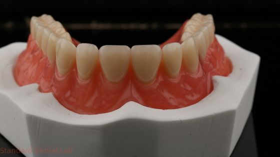 Dentsply Lucitone 199 răng giả acrylic cho Full Arch nhìn tự nhiên