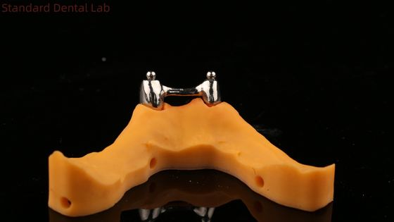Ivoclar Digital Dental Implant Bar Denture with Attachments, Full Acrylic Titanium Implant Supported Dentures