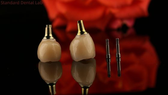 Porcelain Zirconia Cement giữ lại cấy ghép vít hình dạng đầu hình lục giác cho thẩm mỹ phù hợp tùy chỉnh