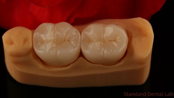 Full Contour Zirconia Crown Sức mạnh và thẩm mỹ đặc biệt Không có lớp phủ sứ Crown phía sau Trung Quốc Phòng thí nghiệm nha khoa