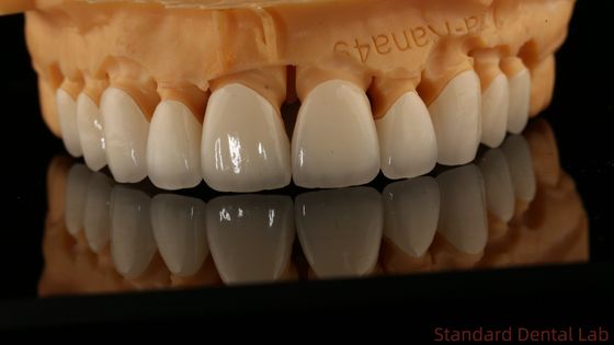 Full Contour phòng thí nghiệm nha khoa vương miện cao xuyên suốt Solid Zirconia Crown Trung Quốc phòng thí nghiệm nha khoa