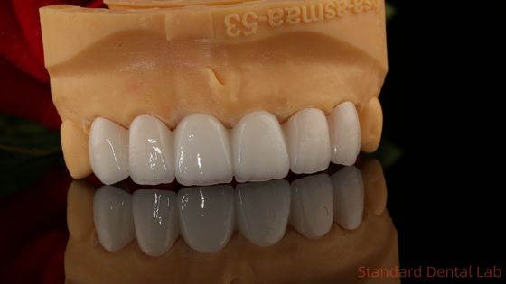 Full Contour Zirconia vương miện xuyên suốt 3D PRO Không lớp phủ sứ Phòng thí nghiệm nha khoa tiêu chuẩn