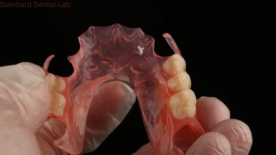 Ace Teeth Pink/Dark TCS Valplast Flexible Partial Dentures for High Aesthetics Dental 3D Print Model