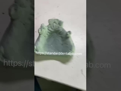 Fast và Cast Frame Co-Cr Metal phần răng giả khung cho các chuyên gia nha khoa