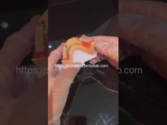 High Esthetics acrylic răng giả một phần với khóa rõ ràng và răng acrylic Trung Quốc Phòng thí nghiệm nha khoa