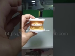 Có thẩm mỹ cao BruxZir Full Contour Zirconia Crown PFZ Bridge