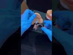 Khung rõ ràng Acrylic kim loại phần răng giả Khung thẩm mỹ cao Trung Quốc phòng thí nghiệm nha khoa