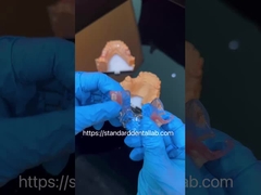 FDA Cobalt Chrome cao thẩm mỹ khung rõ ràng