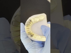 Kim loại đúc Post Core Crown Cocr chính xác giữ đầy đủ Zirconia Bruxier