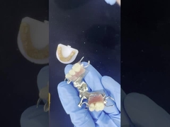 Khả năng tùy biến Cobalt Chrome Cast Frame với các nhãn dán rất tốt