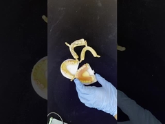 Dentsply Lucitone 199 răng giả acrylic cho Full Arch nhìn tự nhiên