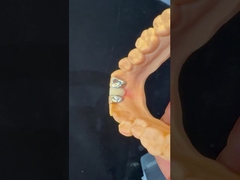 Răng răng PFM Maryland Bridge thẩm mỹ cao FDA chứng nhận