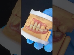 Mô hình in 3D thẩm mỹ cao nha khoa TCS Valplast Dentures linh hoạt phần nha khoa phòng thí nghiệm nha khoa