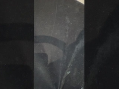 Mùi vịt được hỗ trợ bằng cấy ghép răng giả Mùi vịt chính xác trên cấy ghép