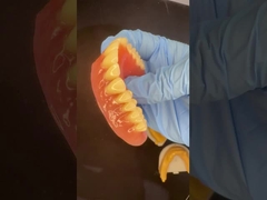 Toàn bộ trên và dưới Standplate Acrylic răng giả một phần Ivoclar răng màu hồng