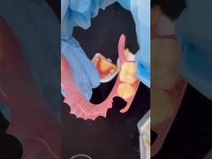 Mô hình in 3D thẩm mỹ cao nha khoa TCS Valplast Dentures linh hoạt phần nha khoa phòng thí nghiệm nha khoa